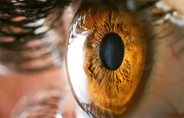 যদিও চোখে ঝাপসা দেখা, একটা জিনিস দুটো দেখা, লেন্সের রঙ ঘোলা হয়ে যাওয়া, আলোয় কম দেখার মতো সমস্যা টের পেলে অবিলম্বে চিকিৎসকের পরামর্শ নিন। ছবি: সংগৃহীত