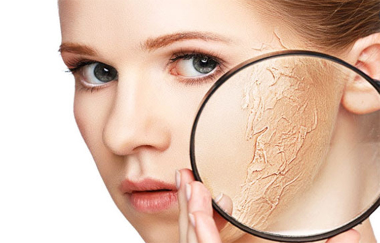 লেবু ও চিনি একসঙ্গে ফুটিয়ে নিয়ে ঠান্ডা করে ঘরেই ওয়াক্স বানানো যায়। ভালো মতো খেয়াল করতে হবে যেন এতে কোনো দানা না থাকে। এরপর ওয়াক্সটি লোমের দিক অনুযায়ী লাগিয়ে একটা কাপড়ের সাহায্যে চাপ প্রয়োগ করে লোম টান দিয়ে উঠাতে হবে। ছবি: সংগৃহীত