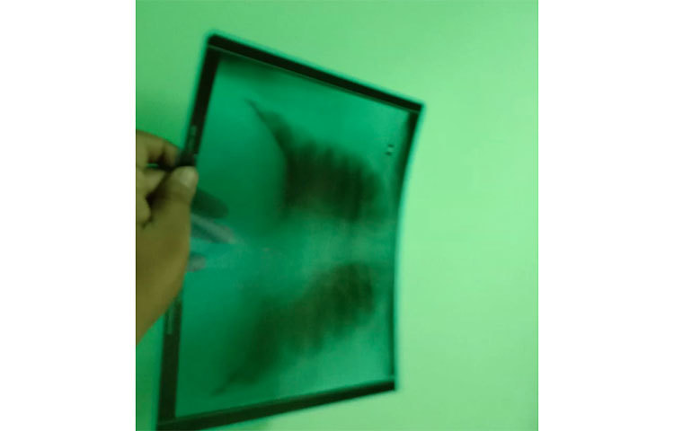 হঠাৎই ভাবনা এসেছিল মাথায়। সাধারণ ফেস শিল্ডেরস্বচ্ছ গার্ডের জায়গায় যদি এক্সরে প্লেট বসিয়ে দেওয়া যায় তাহলেই কেল্লা ফতে। যেমন ভাবা তেমনি কাজ। এভাবেই অভিনব পদ্ধতিতে বিক্রেতারা বানিয়ে ফেলেছে অভিনব ফেস শিল্ড।