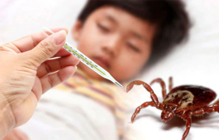 ‘স্ক্রাব টাইফাস’ এই নামের সৃষ্টি হয়েছে গ্রিক শব্দ ঃুঢ়যঁং থেকে যার অর্থ হল ধোঁয়াটে বা অস্পষ্ট। ট্রম্বিকিউলিড মাইটস বা টিকের (ঃরপশ) মতো পরজীবী মাকড়ের কামড় থেকে এই এই রোগের জীবাণু ছড়ায়। ট্রম্বিকিউলিড মাইটস বা টিকের আকার ০.২ মিলিমিটার থেকে ০.৪ মিলিমিটার পর্যন্ত হয়। ‘স্ক্রাব টাইফাস’ একটি ব্যাকটেরিয়াঘটিত রোগ। প্রধানত ‘ওরিয়েনসিয়া শুশুগামুসি’ নামের ব্যাক্টেরিয়াই এ রোগের জন্য দায়ি।