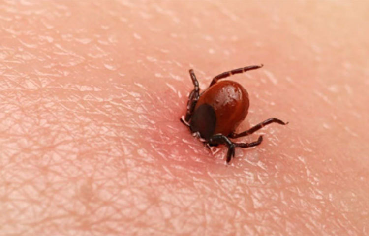 ডেঙ্গু বা টাইফয়েডের সঙ্গে স্ক্রাব টাইফাসের উপসর্গগুলোর অনেক মিল রয়েছে। সে জন্যই প্রাথমিকভাবে এটিকে আলাদা করে শনাক্ত করা মুশকিল হয়। শরীরে জীবাণু সংক্রমিত হওয়ার প্রায় ১-২ সপ্তাহ পর শীত শীত ভাব, কাঁপুনি-সহ আকস্মিক জ্বর, মাথা ব্যথার মতো উপসর্গ দেখা দেয়। এই উপসর্গগুলো দেখা দেওয়ার ৩ থেকে ৫ দিন পরে শরীরের বিভিন্ন অংশে ফুসকুড়ি দেখা দেয়।