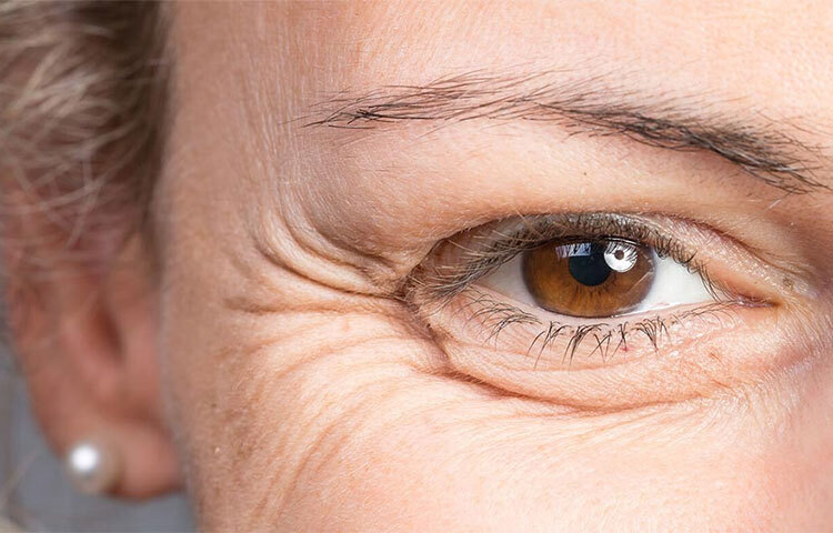 মুখের চামড়া যেন কুঁচকে না যায়, সেই কারণে নামি ব্র্যান্ডের বহু দামি প্রসাধনী ব্যবহার করা হয়। কিন্তু এর বদলে ব্যবহার করা যায় ফিটকিরিও। ছবি: সংগৃহীত