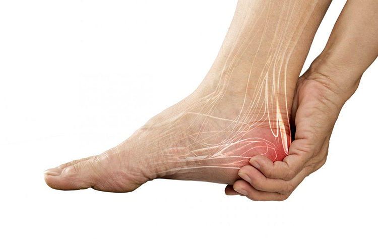 সঠিক কারণ এখনো অজানাই। তবে, সম্ভাব্য কারণের মধ্যে রয়েছে, অনেকক্ষণ এক জায়গায় বসে থাকা, পায়ের পেশিতে অতিরিক্ত চাপ পড়া, কংক্রিটের মেঝেতে অনেকক্ষণ দাঁড়িয়ে কাজ করলে, ঠিকঠাকভাবে না বসলেও মাসল ক্র্যাম্প হয়ে থাকে। ছবি: সংগৃহীত