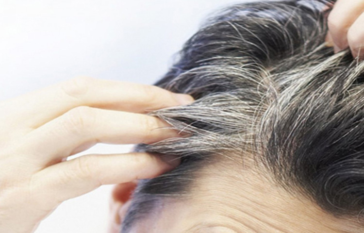 ছোটখাটো নানা কারণে দুশ্চিন্তা বা স্ট্রেস হওয়া স্বাভাবিক ব্যাপার। কিন্তু কিছু মানুষ আছেন যারা সব বিষয়ে অহেতুক স্ট্রেস করেন। অতিরিক্ত স্ট্রেসের জন্য এদের খাবার হজম হয় না এবং অনিদ্রা দেখা দেয়। আর এর থেকেই চুলে পাক ধরতে শুরু করে। সমাধান হিসেবে ধ্যান বা মেডিটেশন শুরু করা উচিত। এমন কাজে নিজেকে নিযুক্ত করা উচিত যা মানসিক চাপ থেকে মুক্তি দেয়। ছবি: সংগৃহীত