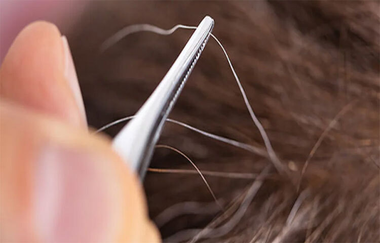 পাকা চুল তুলতে আরাম লাগে ঠিকই তবে পাকা চুল তুলতে বারণ করার পিছনে রয়েছে যথেষ্ট যুক্তিসঙ্গত কারণ। ছবি: সংগৃহীত