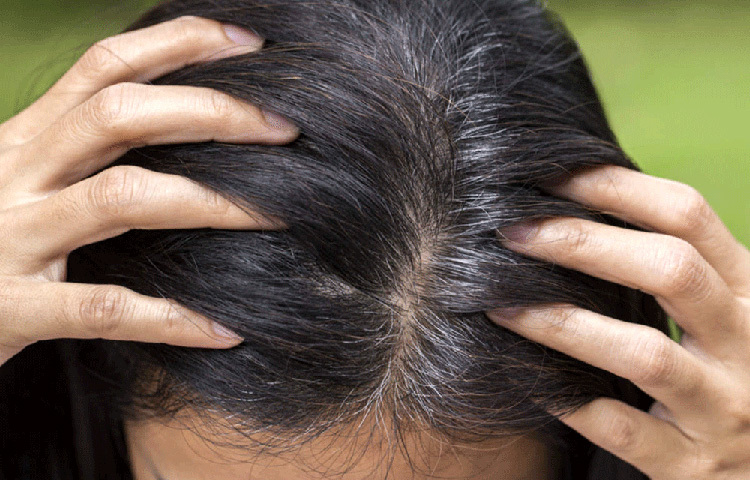 তেল দিলে চুল চিটচিটে হয়ে যাবে বলে অনেকেই এটা এড়িয়ে চলেন। অথচ চুলে তেল মালিশ করলে সেবাম উৎপাদন ঠিক থাকে। ফলে স্কাল্পে চুলকানি হয় না ও স্কাল্প শুষ্ক হয় না। অল্প গরম তেল চুলে মালিশ করলে রক্ত সঞ্চালন বৃদ্ধি পায় ও চুল ভালো থাকে। যদি নিয়মিত চুলে তেল মালিশ করা যায় তাহলে সময়ের আগে চুল পাকা বন্ধ করা সম্ভব। ছবি: সংগৃহীত