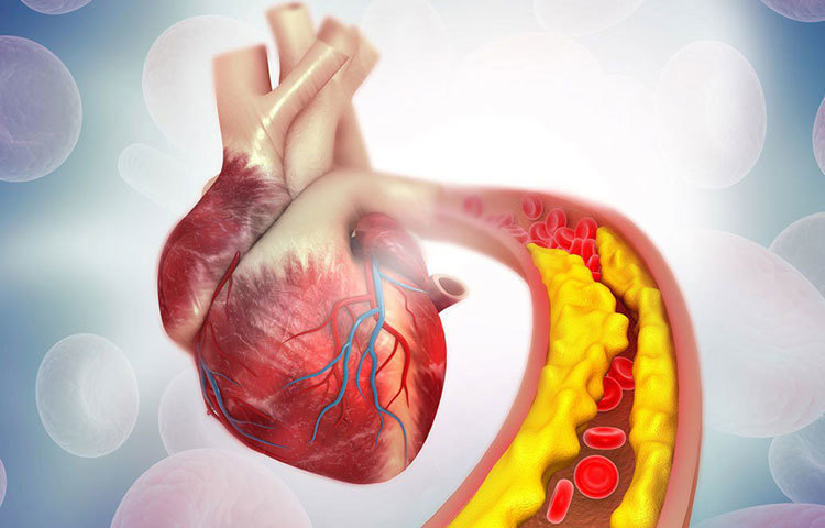 একজন সুস্থ সবল মানুষের রক্তে কোলেস্টেরলের মাত্রা হওয়া উচিত প্রতি ডেসিলিটারে ১৬০ মিলিগ্রামেরও কম। জানেন, কী কী অভ্যাস আয়ত্তে আনলে সহজেই খারাপ কোলেস্টেরলকে ছেঁটে ফেলতে পারবেন শরীর থেকে?