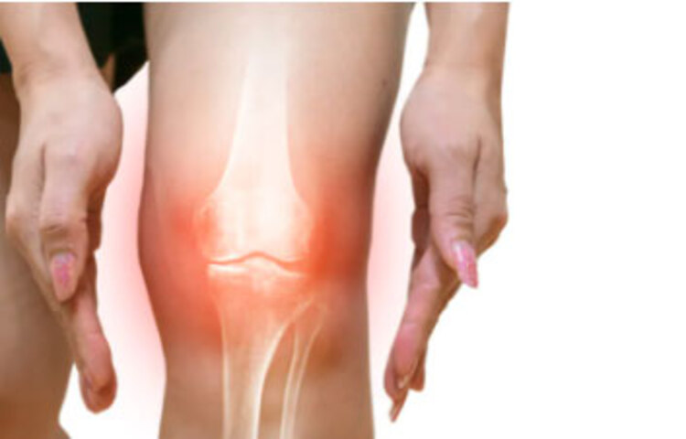 যাদের হাঁটু ব্যথা আছে, তারা কঠিন ব্যায়াম করবেন না। বরং ধীরে-সুস্থে এক জায়গায় ঘুরতে পারেন, এটা অনেক বেশি উপকারি।