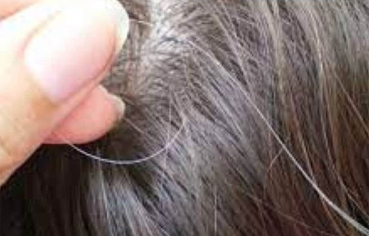 বর্তমানে কৈশোর এমনকি শৈশবেও চুল কারো কারো চুল পেকে যাচ্ছে। একাধিক কারণে এই সমস্যা দেখা যাচ্ছে। এই সমস্যার জন্য একাধিক কারণ দায়ী। চুল পেকে যাওয়ার কারণ চুলের গোড়ায় পিগমেন্টেশনের জন্য মেলানিনের উৎপাদন কমে যায়। ফলে কালো চুল সাদা হয়ে যায়। ছবি: সংগৃহীত