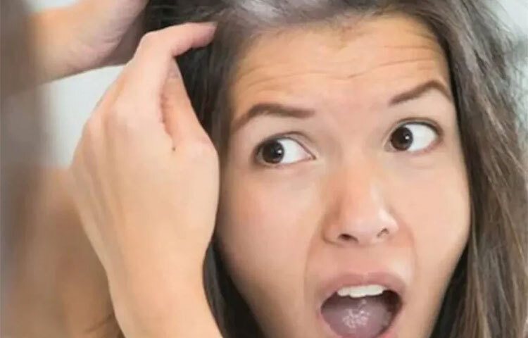 মেলানিনের যোগান কমে যায় মূলত জিনগত কারণে। পরিবারে কারো অকালপক্বতার সমস্যা থাকলে প্রতি প্রজন্মেই এই সমস্যা দেখা দিতে পারে। ভিটামিন ডি, ভিটামিন বি-১২র যোগান কমলেও চুল পেকে যেতে পারে বার্ধক্যের আগেই। ছবি: সংগৃহীত