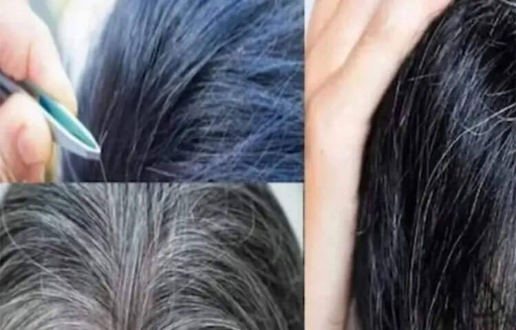 থাইরয়েড, অপর্যাপ্ত ঘুম, মানসিক উদ্বেগসহ একাধিক কারণ দায়ী থাকে অকালে চুল পেকে যাওয়ার পিছনে। যে বয়সেই চুল পাকুক না কেন, বলা হয় পাকা চুল হাত দিয়ে টেনে না তুলতে। তাতে নাকি আরও চুল পেকে যায়। কিন্তু সেটা ঠিক নয়। ছবি: সংগৃহীত