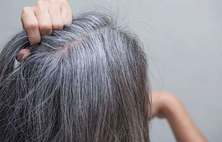 হাত দিয়ে টেনে চুল তোলার প্রবণতা থাকলে মাথার কোনো কোনো অংশে স্থায়ীভাবে চুল উঠে গিয়ে টাকও পড়ে যেতে পারে। তাই পাকা চুল ট্রিম করুন কাঁচি দিয়ে কেটে। ছবি: সংগৃহীত