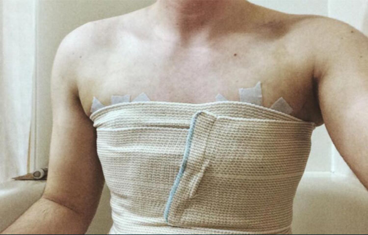 প্রথমেই অস্ত্রোপচার করে নিজের শরীর থেকে স্তনদুটি বাদ দেন ইশা। তিনি জানিয়েছেন, নিজেকে একজন সম্পূর্ণ পুরুষ হিসেবে দেখতে তিনি এতটাই আগ্রহী ছিলেন যে এ ব্যাপারে একটুও দেরি করতে চাননি। ছবি: সংগৃহীত