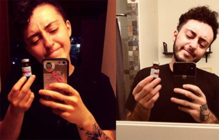 পাশাপাশি হরমোনের চিকিৎসাও শুরু করা হয়। পুরুষদেহে যে হরমোনের প্রভাব সবচেয়ে বেশি, সেই টেস্টোস্টেরন হরমোন নিয়মিতভাবে নিতে শুরু করেন তিনি। ছবি: সংগৃহীত