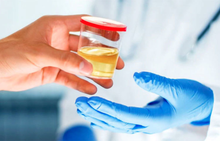 বছরে অন্তত একবার প্রসাবের মাইক্রো-এলবুমিন পরীক্ষা করান।