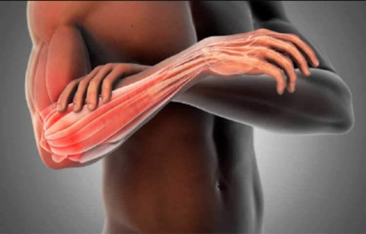 হঠাৎ করে হাঁটা-চলার পথে কনুইয়ে কিছুর হালকা টোকা লাগলে শরীরে কেমন একটা বৈদ্যুতিক শক লাগে। মনে হয় গোটা শরীরে কেউ ইলেকট্রি শক দিয়েছে। ছবি: সংগৃহীত