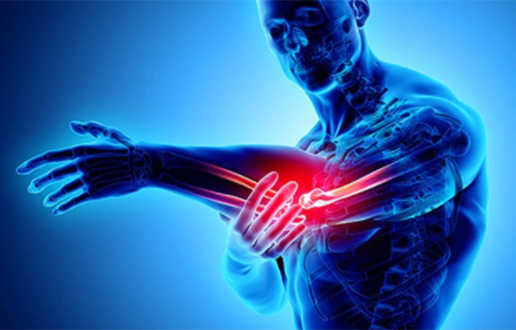 ওই টানেলের স্থানে স্নায়ুটির একপাশ কনুইয়ের হাড়ের সঙ্গে যুক্ত থাকে এবং অন্যপাশ আমাদের ত্বকের সঙ্গে। ফলে ওই স্থানে স্নায়ুটি সবচেয়ে বেশি সংবেদনশীল থাকে। ছবি: সংগৃহীত