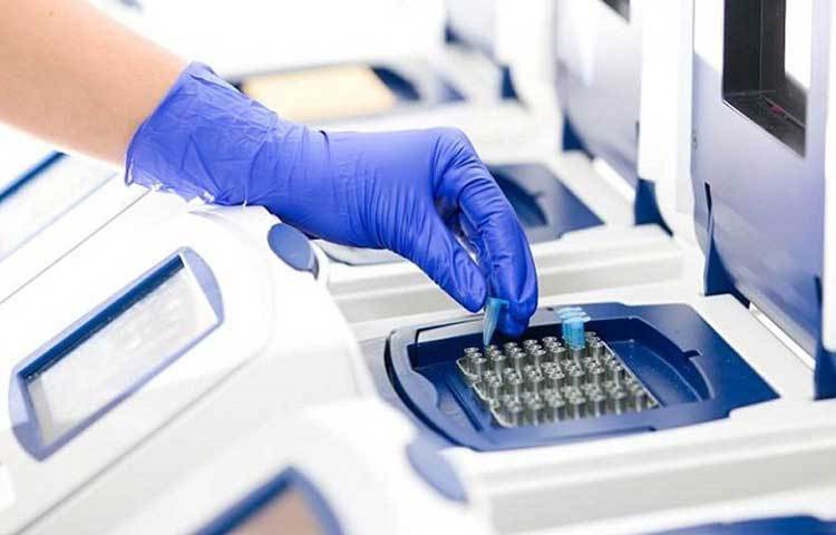 এর জন্য নির্দিষ্ট যন্ত্র রয়েছে। সেই যন্ত্রে কোভিড-১৯ ভাইরাসের জেনেটিক কপি রয়েছে। এখন রোগীর থেকে সংগৃহীত নমুনার সঙ্গে মেশিনে থাকা ওই ভাইরাসের জেনেটিক কোড মেলানো হয়। যদি মিলে যায়, তা হলে রোগী কোভিড-১৯ পজিটিভ।