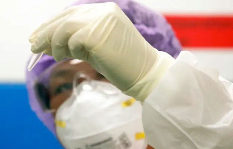 দেখা গিয়েছে করোনাভাইরাস সবচেয়ে বেশি দিন বাঁচতে পারে পলিপ্রোপিলিনের উপর। পাঁচ দিন পর্যন্ত এর উপর বেঁচে থাকতে পারে করোনাভাইরাস।