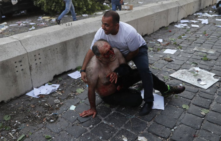 বার্তা সংস্থা রয়টার্স কর্মকর্তাদের বরাতে জানিয়েছে, যে স্থানটিতে বিস্ফোরণ ঘটেছে, সেখানে বন্দরের গুদাম রয়েছে। রাসায়নিকের মজুদ থাকা বন্দরের গুদামে প্রথম আগুন লাগার কথা জানা গেছে।