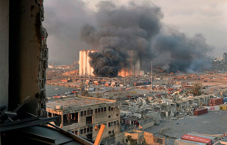 একসঙ্গে এত আহত মানুষের সেবা দিতে হিমশিম খাচ্ছে বৈরুতের হাসপাতালগুলো।