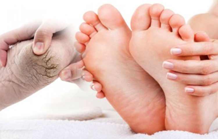 নারকেল ও কলার ফুট মাস্ক: পা ফাটার সমস্যা মারাত্মক পর্যায়ে চলে গেলে এই ফুট মাস্কটি ব্যাবহার করার চেষ্টা করুন। সমস্যার সমাধান হবে খুব দ্রুত। এর উপকরণ হচ্ছে টুকরো করে কাটা কলা, লম্বা করে কাটা ৩-৪ টুকরো নারকেল।