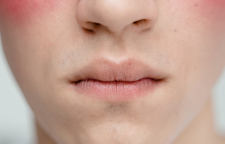 নারিকেল তেল সাধারণত চুলে এবং ত্বকের ব্যবহার ব্যাপক জনপ্রিয়। এমনকি অতিরিক্ত রুক্ষ ত্বকের জন্য নারিকেল তেলের কার্যকারিতা বেশ লক্ষণীয়। ছবি: সংগৃহীত