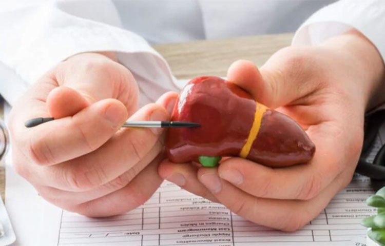 মাত্রাতিরিক্ত পরিমাণে তেল, মশলাদার খাওয়া-দাওয়া করলেও হতে পারে লিভারের ক্ষতি। প্রতিদিন মাত্রাতিরিক্ত পরিমাণে খেলে লিভারের উপর বাড়তি চাপ পড়ে। যার ফলে ক্ষতিগ্রস্ত হয়ে লিভার।