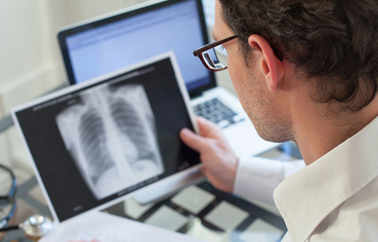 ‘ল্যান্সেট ম্যাগাজিন ইনফেকশস ডিজিজেস’ নামে একটি রিপোর্টে জানাচ্ছে যক্ষ্মা বা এইচআইভি-এর থেকে কিছু কম ভয়ঙ্কর নয় এই রোগ। এবং শুধু ইউরোপ নয়, সারা বিশ্বেই ধীরে ধীরে থাবা বসাচ্ছে এই রোগ। আমাদের দেশে প্রতি বছরই এমন কিছু ব্যাকটেরিয়াঘটিত অসুখের দেখা মেলে, যা প্রায় কোনো রকম অ্যান্টিবায়োটিকেই আয়ত্তে আসে না।