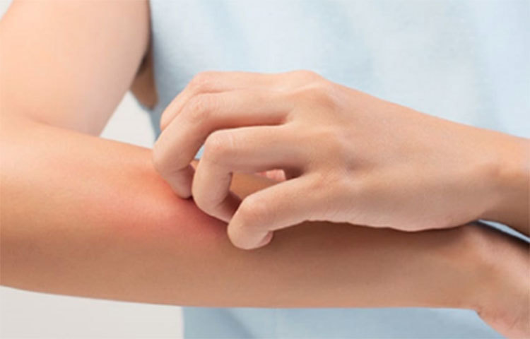 শরীরে ফাঙ্গাল ইনফেকশন, বিশেষ করে বর্ষাকালে, খুব সাধারণ সমস্যা। নিয়মিত সর্ষের তেল ব্যবহার করলে ফাঙ্গাল ইনফেকশন প্রতিরোধ করা সম্ভব। শরীরে ফাঙ্গাল ইনফেকশন, বিশেষ করে বর্ষাকালে, খুব সাধারণ সমস্যা। নিয়মিত সর্ষের তেল ব্যবহার করলে ফাঙ্গাল ইনফেকশন প্রতিরোধ করা সম্ভব।