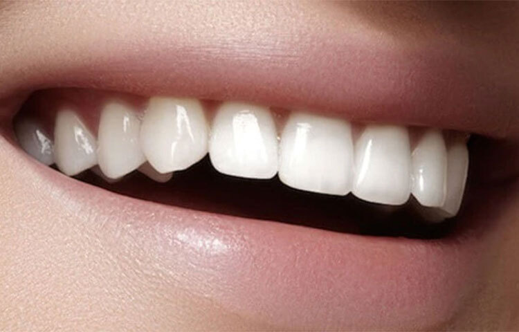 দাঁতের সমস্যায় দুধ খুবই কার্যকরী। দাঁতের ক্ষয় রুখতে দুধ খুবই কার্যকরী, কারণ, দুধে আছে ক্যালশিয়াম। ছবি: সংগৃহীত