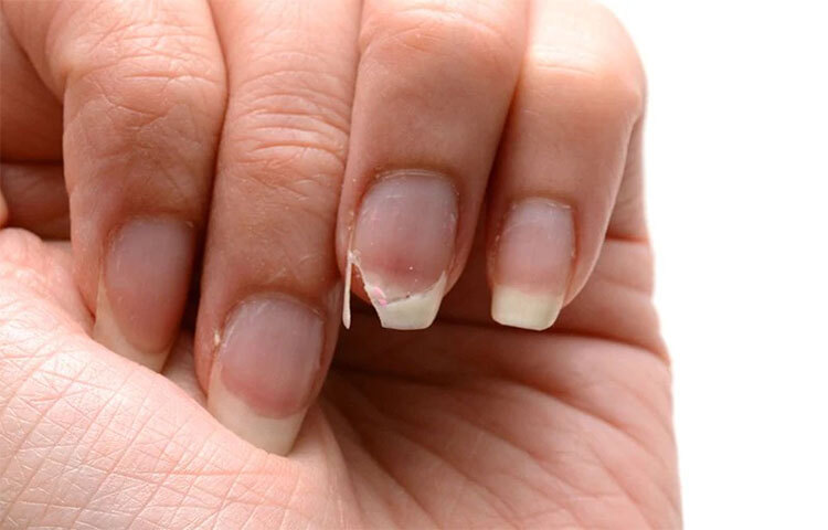 লেবুর রস: ভিটামিন সি নখ বৃদ্ধিতে সাহায্য করে। দিনে অন্তত একবার হাত ও পায়ের নখে লেবুর রস ঘষতে হবে। পাঁচ মিনিট ঘষে গরম পানি দিয়ে ধুয়ে ফেলতে হবে। এটি নখ বাড়াতে সাহায্য করবে। পাশাপাশি নখকে পরিষ্কার এবং ব্যাকটেরিয়া মুক্ত রাখবে। ছবি: সংগৃহীত