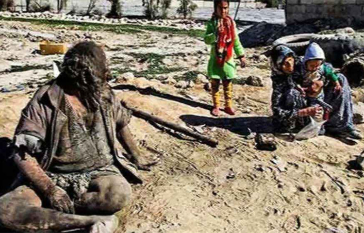 গোসল না করা বা অপরিচ্ছন্ন থাকা ছাড়াও তার খাদ্যাভ্যাসও বেশ উদ্ভট। ছবি: সংগৃহীত