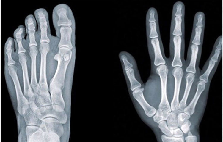 ডাক্তারি পরীক্ষার বিভিন্ন এক্সরের পেশা।