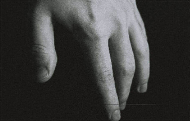 নখ যদি খুব ভঙ্গুর হয় এবং বড় হতে সময় নেয়, তাহলে সেটা প্রোটিন কমে যাওয়ার লক্ষণ। ছবি: সংগৃহীত