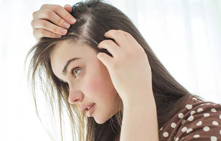 অতিরিক্ত চুল পড়লে, স্ক্যাল্প শুকনো ও চুলকানিপ্রবণ হলে সেটি প্রোটিনের প্রয়োজন মনে করিয়ে দেয়। ছবি: সংগৃহীত