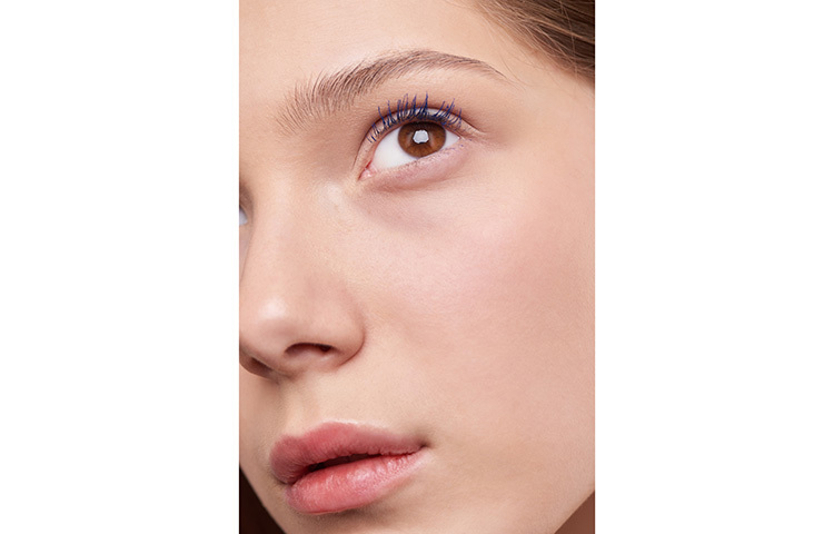 আমাদের মানুষের মধ্যে সাধারণত এই ৪ ধরণের ত্বকজনিত সমস্যা সবচেয়ে বেশি দেখা যায়, মেলাসমা, প্রদাহজনিত হাইপারপিগমেন্টেশন, লেন্টিজিনস এবং পেরিঅরবিটাল হাইপারপিগমেন্টেশন। ছবি: সংগৃহীত