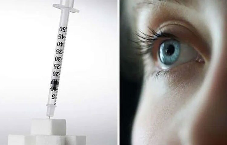 ঝাপসা দৃষ্টি এবং ঘন ঘন মাথাব্যথা, হাই ব্লাড সুগারের কারণে চোখের লেন্সগুলো ফুলে উঠতে পারে বা দৃষ্টি বিকৃত করতে পারে, যার ফলে ঝাপসা বা দ্বিগুণ দৃষ্টি দেখা যায়। ডায়াবেটিস রোগে রেটিনার রক্তনালী ফুটো হতে পারে, বা অস্বাভাবিক নতুন রক্তনালী বৃদ্ধি পেতে পারে, যার ফলে দৃষ্টি সমস্যা হতে পারে। একে ডায়াবেটিক রেটিনোপ্যাথি বলে। জনস হপকিন্স মেডিসিন অনুসারে, ডায়াবেটিক নিউরোপ্যাথি আমেরিকান প্রাপ্তবয়স্কদের অন্ধত্বের প্রধান কারণ। ছবি: সংগৃহীত