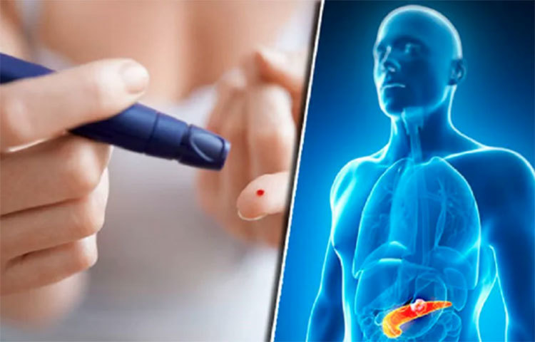 সেপসিস-এর মতো ভয়ানক রোগেরও উপসর্গ এটি। বিভিন্ন ধরনের জীবাণু থেকে শরীরে ইনফেকশনের ফলে এমন প্রভাব পড়ে যে গলা প্রায় শুকিয়ে যায়।