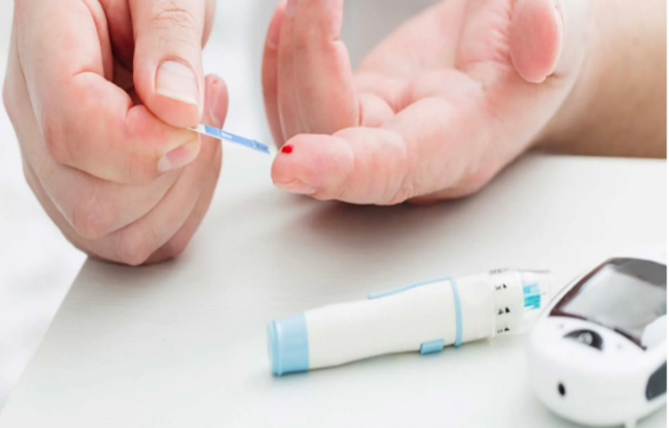 বয়সের কারণে ত্বকে বলিরেখা দেখা দেওয়া স্বাভাবিক। কিন্তু যদি কালো বা বেগুনি ছোপ দেখা যায় ত্বকে, বা কনুই, গোড়ালির মতো জায়গা কালো হয়ে যেতে থাকে তা হলে অবশ্যই আপনার রক্তে শর্করার মাত্রা বেশ বেশি। ছবি: সংগৃহীত