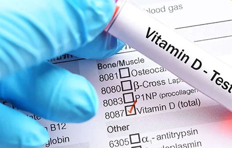 ৪০ বছরের ঊর্ধ্বে থাকা ব্যাক্তিদের ধূমপান অনেক বেশি ঝুঁকিসাপেক্ষ। বেশিরভাগ ধূমপায়ীদের রক্তে সাধারণত ভিটামিন ডি কম থাকে। তাই এই পরীক্ষা একজন ধূমপানকারী ব্যক্তির জন্য ভীষণ জরুরি। ছবি: সংগৃহীত