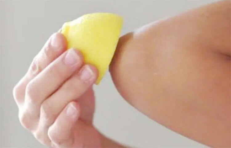 চিনি ও লেবু: পানিতে এক চামচ চিনি মিশিয়ে খানিকটা ফুটিয়ে নিন। চিনি গলে পানিতে মিশে যাওয়ার পর ঠান্ডা করে নিন সেই মিশ্রণ। এবার এই চিনির রস লেবুর গায়ে মাখিয়ে কালো দাগের উপর লেবুটা ঘষতে থাকুন বেশ খানিকক্ষণ। মিনিট দশেক পর ভালো করে ধুয়ে নিন। এভাবে কিছুদিন করলেই উপকার পাবেন। ছবি: সংগৃহীত