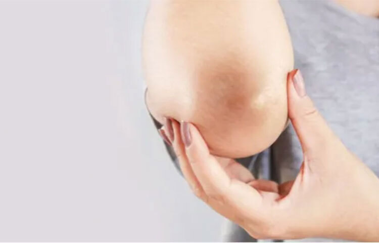 বেসন লোমকূপের ভিতরে লুকিয়ে থাকা ময়লা সরাতে কাজে আসে। সঙ্গে যোগ হয় দই ও লেবুর অ্যাসিড। তিনে মিলে দীর্ঘমেয়াদী কালো দাগ দূর করে। ঘরোয়া এই উপায়গুলি অবলম্বন করলেই সহজে পাবেন ফল। ছবি: সংগৃহীত