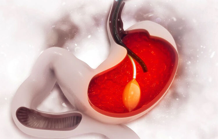 আমরা যে মাংস বা আমিষ খাবার খাই তা ভেঙে ভেঙে হজমের জন্য উপযুক্ত করে তোলে। এর দ্বিতীয় গুরুত্বপূর্ণ কাজ হলো শরীর জীবাণুমুক্ত রাখা। অনেক সময় খাবারের সঙ্গে এমন জীবাণু আমাদের শরীরের ভিতরে চলে যায় যা আমাদের অনেক ক্ষতি করতে পারে। কিন্তু এই অ্যাসিড সেই জীবাণুকে মেরে ফেলে। এইভাবে এটি সেই জীবাণুগুলোর বিরুদ্ধে লড়াইয়ের প্রথম বাধা হিসাবে প্রমাণিত হয়। এটি একটি ব্যাটারির অ্যাসিডের মতো দ্রুত কাজ করে। ছবি: সংগৃহীত