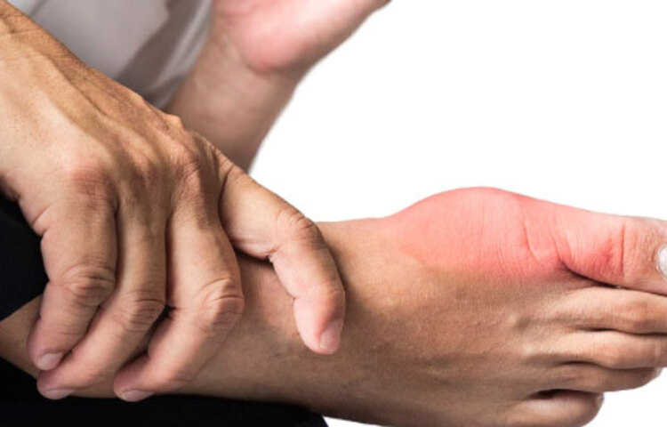 মাত্রা অতিরিক্ত চিনি খাওয়া রক্তে ইউরিক অ্যাসিড বৃদ্ধি পায়। বাড়িয়ে দেয় সি- পেপটাইডের ঘনত্বও।