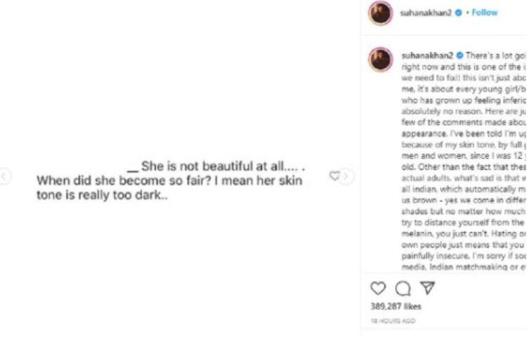 সুহানা যেহেতু কৃষ্ণাঙ্গ তাই তাকে ‘কালি চুড়েল’ ও বলা হয়েছে। যে শব্দের অর্থ ‘কালো পেত্নি’। তিনি একাধিক এই ধরণের বিদ্বেষমূলক মেসেজ শেয়ার করে বার্তা দিয়েছেন এবার এগুলো বন্ধ করা উচিত। তিনি কড়া ভাষায় জানিয়েছেন নিজের গায়ের রঙ ও তাকে কেমন দেখতে দুটো নিয়েই তিনি দারুণ খুশি।