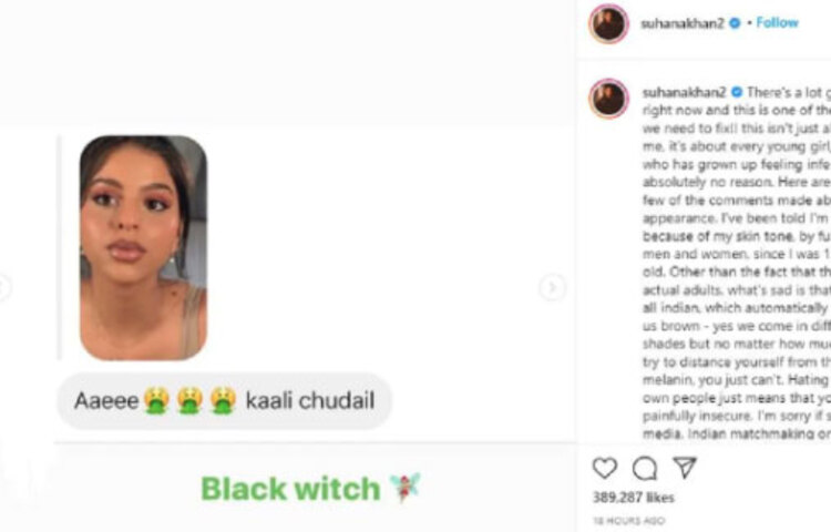 ‘অদ্ভুত এরা সকলেই প্রাপ্তবয়স্ক। ভারতীয়দের স্বাভাবিকভাবেই গায়ের রঙ বাদামি হয়। যতই চেষ্টা করা হোক মেলানিন থেকে দূরে থাকতে কোনোভাবেই সেটা সম্ভব হয় না। তাই নিজের লোকেদের এভাবে ঘৃণা করার মানে আপনি খুব খারাপভাবে নিরাপত্তাহীনতায় ভোগেন।