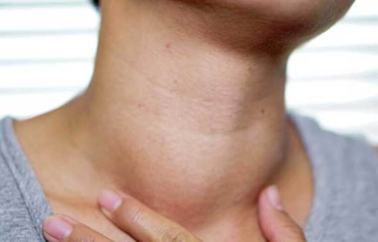 থাইরয়েড গ্রন্থির কাজে ভারসাম্য বজায় রাখে: শরীরে সঠিক মাত্রায় তামা থাকলে তা থাইরয়েড গ্রন্থি থেকে অতিরিক্ত হরমোন নিঃসরণ আটকাতে সহায়তা করে। এবং এর কাজের মধ্যে ভারসাম্য বজায় রাখতে সাহায্য করে। ছবি: সংগৃহীত