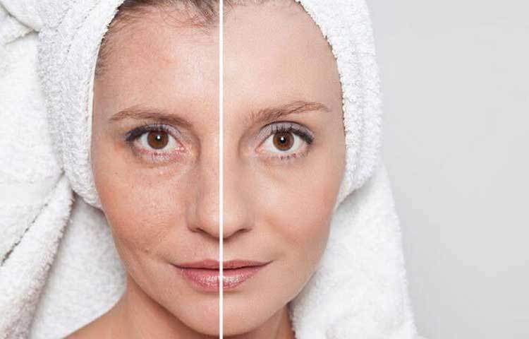 মলিন ত্বকের সমস্যায় ও চোখের নিচের কালচেভাব দূর করতে হলুদ খুবই উপকারী। একটি পাত্রে ২ চামচ টক দই, ১ চামচ হলুদ গুঁড়ো, ১ চামচ ময়দা, ১ চামচ মধু ভালো করে মিশিয়ে নিন। মিশ্রণটি গোটা মুখে ভালো করে মেখে অন্তত ২০ মিনিট রেখে তারপর ধুয়ে ফেলুন। এই পদ্ধতিতে হলুদের ব্যহহার ত্বকের মলিনতা ও চোখের নিচের কালচেভাব দূর করতে সাহায্য করবে।