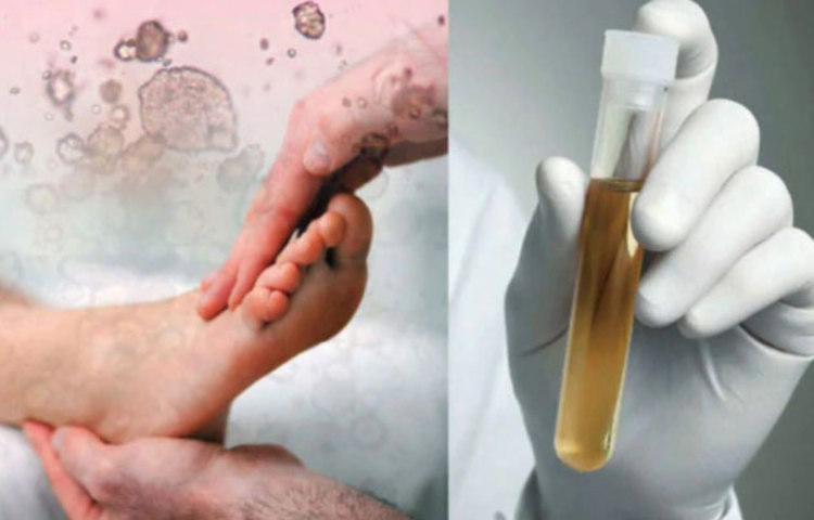 রক্তে ইউরিক অ্যাসিডের মাত্রা বাড়তি দেখে অনেকেই দুশ্চিন্তায় খাওয়া-দাওয়া বন্ধ করে দেন। তবে ইউরিক অ্যাসিডের সমস্যায় খাবার-দাবারে নিয়ন্ত্রণের তেমন একটা প্রয়োজন নেই।